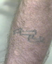 Right forearm tattoo